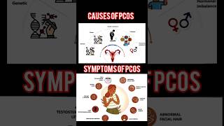 Polycystic Ovarian Syndromepcos pcod pcodtreatment pcosawareness pcosinfertility pcoslifestyle [upl. by Adanar]