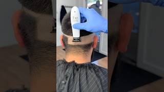 TPOB  Dr barber using the ghost x debulking trimmer [upl. by Auqinahc]