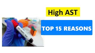 HIGH AST LEVELS  TOP 15 REASONS [upl. by Oilenroc]