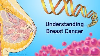 Understanding Breast Cancer [upl. by Attecnoc]