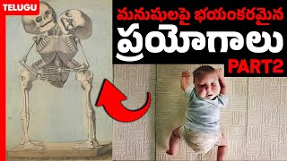 ANGEL OF DEATH  Josef Mengele  Sewing twins  Zoomed Telugu  PART 2 [upl. by Enois32]