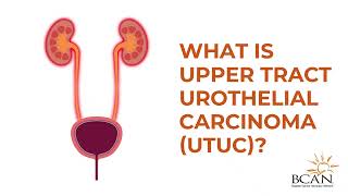 Upper Tract Urothelial Carcinoma  Bladder Cancer Advocacy Network [upl. by Lodovico]