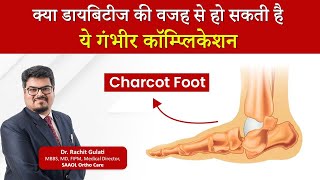 Charcot Foot Symptoms Causes Treatment Complications  Dr Rachit Gulati  SAAOL Ortho Care [upl. by Nerra]