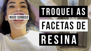 FACETAS DE RESINA  NOVO SORRISO [upl. by Hemphill]