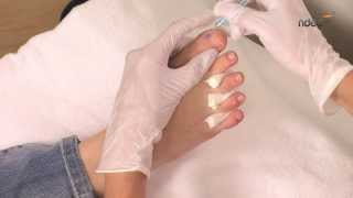 Tuto nail art pour ongles de pied  technique du millefeuille  ndedfr [upl. by Dorkus]