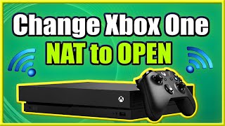 How to Change Xbox One NAT to OPEN and FIX Strict Connection Issues Easy Method [upl. by Ivette]