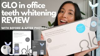 GLO IN OFFICE TEETH WHITENING REVIEW teethwhitening dentist [upl. by Eibrik967]