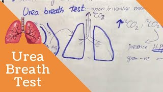 Urea Breath Test  Helicobacter pylori  Infectious Peptic Ulcer [upl. by Atiuqin]