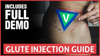 How To Do A Glute Injection  Full Guide And Demo [upl. by Madel]