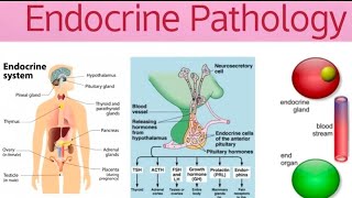 Endocrine Pathoma 3  Hypothyroidism [upl. by Eicyac9]