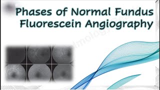 Phases of Normal Fundus Fluorescein Angiography [upl. by Aneeles]