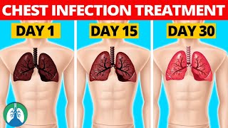 7 Natural Chest Infection Treatments Home Remedies [upl. by Ahseik429]