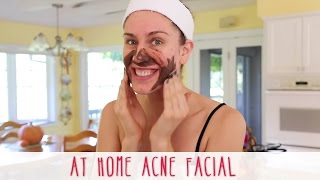 At Home Acne Facial How To Give Yourself A Facial At Home [upl. by Nollad]