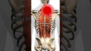 Erector Spinae Trigger Points [upl. by Oetomit]