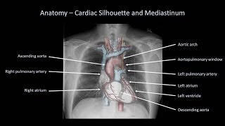 How to Interpret a Chest XRay Lesson 2  A Systematic Method and Anatomy [upl. by Iphigeniah]