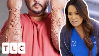 Dr Lee Has NEVER Seen A Case Of Cholesterol Bumps THIS Bad  Dr Pimple Popper [upl. by Austine]