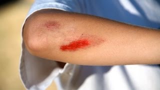 How to Treat Cuts amp Scrapes  First Aid Training [upl. by Eive]