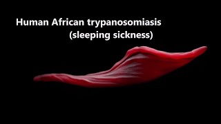 Human African Trypanosomiasis sleepingsickness Trypanosomiasis WHO [upl. by Koziel]