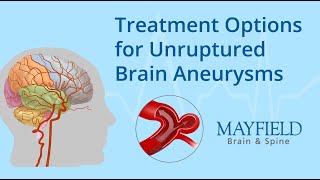 Treatment Options for Unruptured Brain Aneurysms [upl. by Ynohtna548]