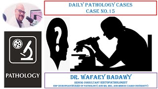 DAILY PATHOLOGY CASES CASE NO 15 BY DR WAFAEY BADAWY [upl. by Tasia]