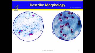 Cryptosporidium Intestinal coccidia [upl. by Corrine515]