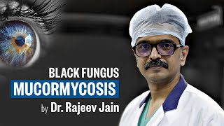 Mucormycosis  Causes and Symptoms  Black Fungus  Save Sight Centre Hospital [upl. by Gui198]