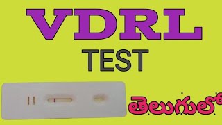 VDRL In TeluguVenereal disease research laboratory vdrl procedure Telugudmlteducation [upl. by Mcfarland]