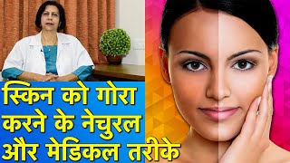 स्किन को गोरा करने के नेचुरल और मेडिकल तरीके  Best Natural amp Medical Methods For Skin Whitening [upl. by Jelle]