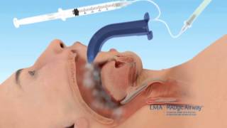 MADgic Airway™  Italiano [upl. by Melva]