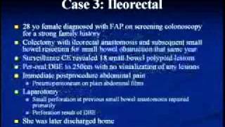 S062 Severe Complications After Double Balloon Enteroscopy [upl. by Enilec]