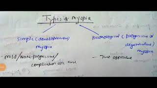 Pathological myopia [upl. by Valsimot]