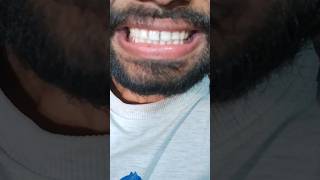 ASMR  FELIX Grape Chewing Gum teethtapping [upl. by Ingold671]