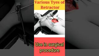 Instrument of the Day Surgical Retractors Types surgicalinstruments viral education neet [upl. by Otrebmal615]