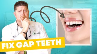 Why You Have GAP TEETH amp How to Fix It [upl. by Eaj31]