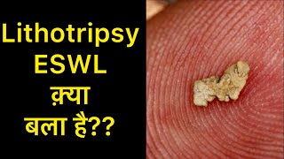 Lithotripsy Treatment for Kidney Stones in Hindi  Lithotripsy Side effects  ESWL Treatment [upl. by Eggett]