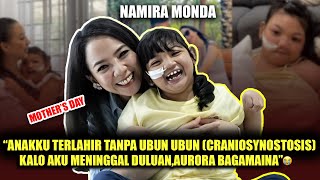 NAMIRA MONDA quotANAKKU TERLAHIR TANPA UBUN UBUN CRANIOSYNOSTOSIS🥹” [upl. by Martie355]