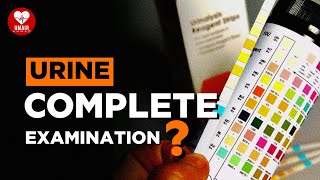 Urine Test Secrets What You Need to Know [upl. by Htennek10]