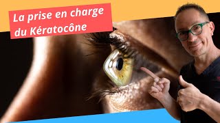 KÉRATOCÔNE Causes et Traitements Maladie des yeux [upl. by Fortier]