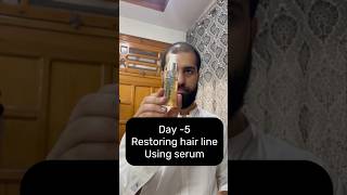 Restoring Hair Line Day5 using serum hairregrowth haircareroutine [upl. by Attenreb]