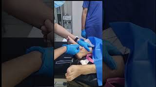 IV canullation how to insert intravenous canulla to vein [upl. by Raff]