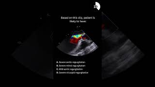 Echocardiography board practice question 13 [upl. by Luehrmann]