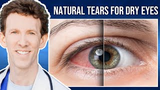 PRP Treatment for Dry Eyes with Dr Scheiner  Ms Dawsons Testimonial [upl. by Duvall]