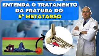 FRATUROU O QUINTO METATARSO SAIBA O TRATAMENTO [upl. by Zerk]