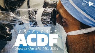 C56 C67 Anterior Cervical Discectomy and Fusion  Case Trailer [upl. by Dinan]