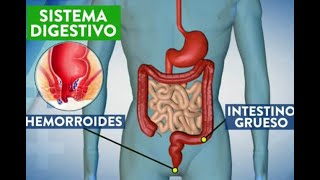 Hemorroides ¿qué son por qué salen y cómo curarlas [upl. by Aitnic]