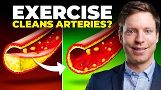 This Exercise Clears Plaque in Your Arteries New Trial [upl. by Cecilia]