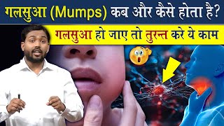 गलसुआ Mumps क्यों हो जाता है  गलसुआ हो जाते तो तुरंत करें ये काम ViralKhanSir [upl. by Oirtemed144]