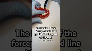 Dental Forceps Used Properly For Tooth Extraction 🦷  OnlineExodontiacom  oralsurgery [upl. by Randee]