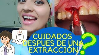 CUIDADOS después de una EXTRACCIÓN DENTAL [upl. by Babs]