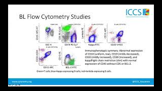 BCell NonHodgkin Lymphoma [upl. by Laenej]